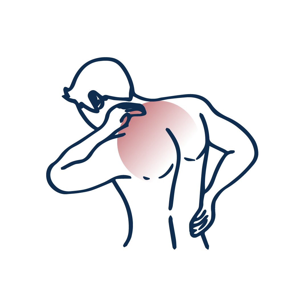 Sciatica, nevralgia